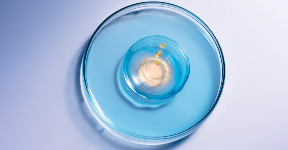 vaseline-bodegon-1