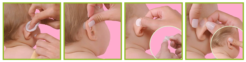 Corrector para orejas separadas Otostick bebé + 1 gorro